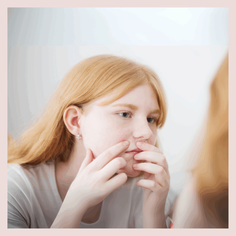 Adolescent qui essaye d'enlever son bouton d'acné.